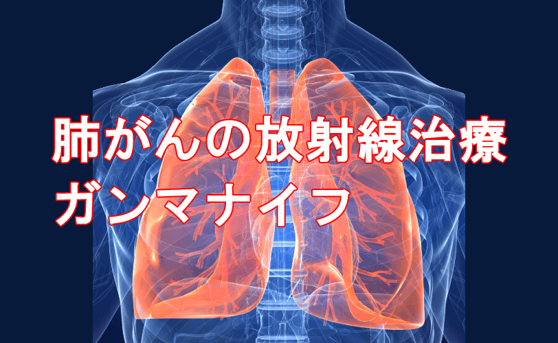 肺癌の放射線療法・ガンマナイフ