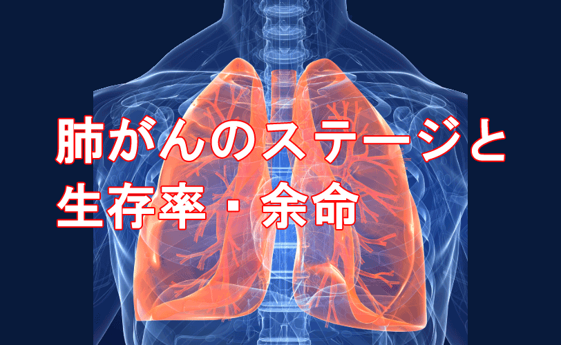 肺癌のステージと生存率・余命