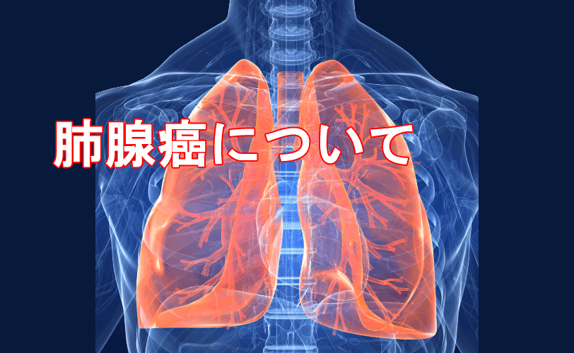 肺腺がん（肺腺癌）について